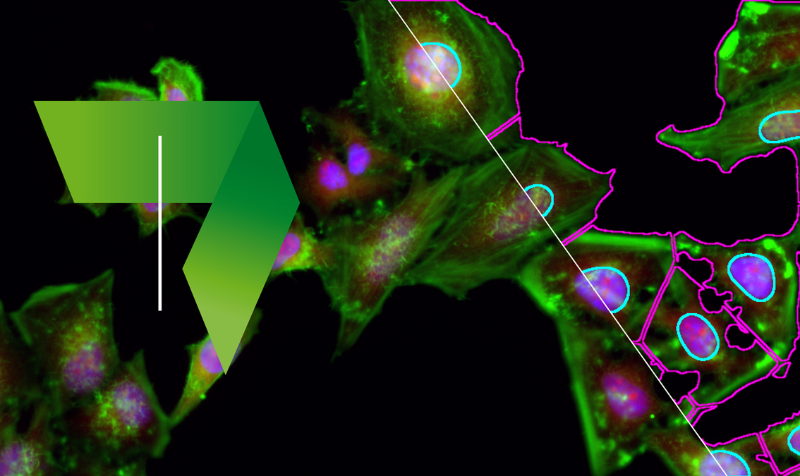 Image Processing and Analysis for Life Scientists IPA4LS